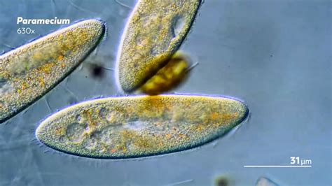  Didinium: ¡Un Cazador Microscópico Con una Boca Voraz que Devorará Cualquier Protista en su Camino!